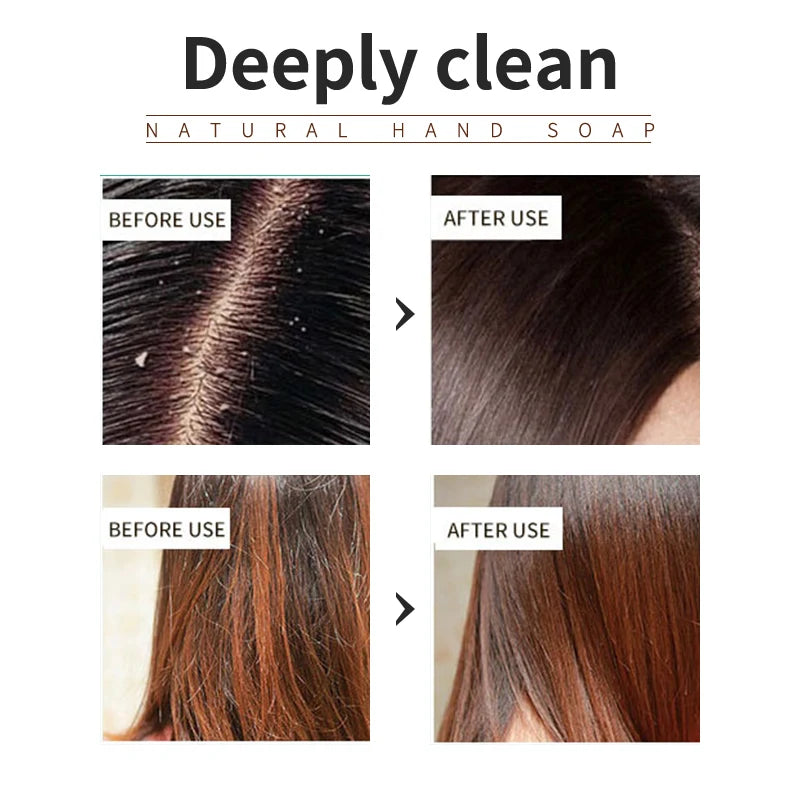 Rosemary Shampoo Soap Without Silicone Oil Plant Shampoo Soap Cleanses the Scalp Nourishes Hair Controls Oil